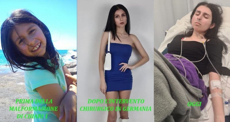 FORNO CANAVESE - Insieme per Rebecca, truffatori sciacalli in azione: false raccolte fondi porta a porta