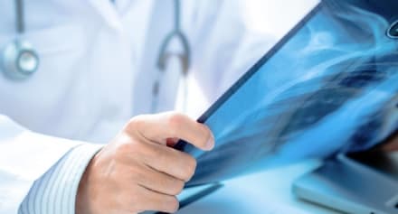 CANAVESE - Radiologia a domicilio: il Lions dona il Fiorino per i pazienti di tutta la zona