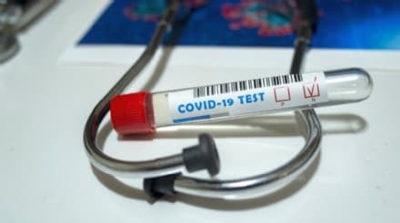 CORONAVIRUS - La Regione: «Non abbiamo perso alcun tampone»