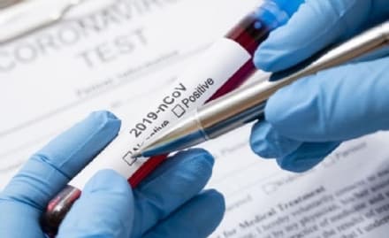 CANAVESE - Emergenza Coronavirus: registrati oggi 250 nuovi casi in Piemonte