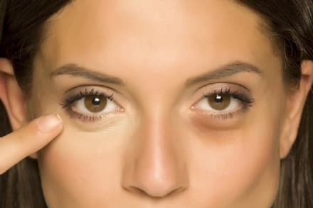 BEAUTY – Vanno di moda le borse sotto gli occhi