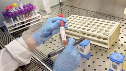 COVID - Cirio: «Mettiamo sempre la mascherina e seguiamo le regole del distanziamento sociale»