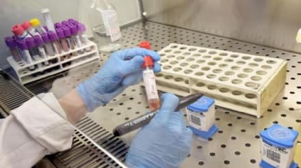 CORONAVIRUS - In Piemonte personale sanitario aumentato di 1467 unità: 52 in Canavese