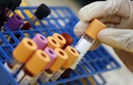 CANAVESE - Fase 2 della sanità, nuove regole contro il covid. Si prenotano anche i prelievi del sangue