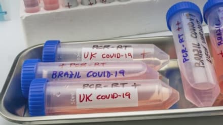 COVID - Prossimo passo: il vaccino universale