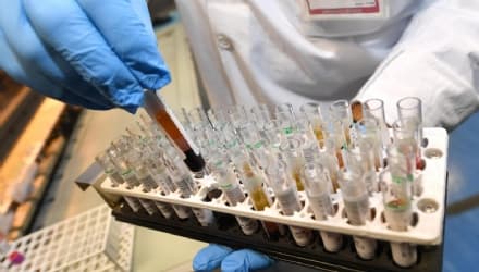 CORONAVIRUS - 56 i casi finora positivi in Piemonte