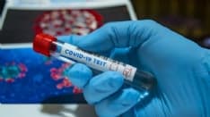 CANAVESE - Covid-19, ora tutti possono fare il test sierologico per scoprire se si è stati colpiti dal virus