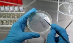 STRAMBINO - Tubercolosi a scuola: controlli estesi anche alle medie