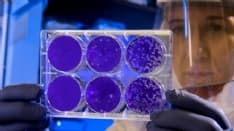 CORONAVIRUS - I morti in Piemonte superano quota 100: altri 17 decessi nella notte