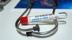 CORONAVIRUS - La Regione: «Non abbiamo perso alcun tampone»