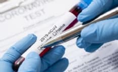 CANAVESE - Emergenza Coronavirus: registrati oggi 250 nuovi casi in Piemonte