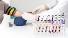 CANAVESE - Sistemi in tilt, saltano i prelievi in tutti i centri Asl