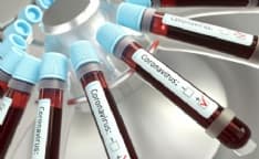 CANAVESE - Emergenza Coronavirus: oggi registrati 225 nuovi casi e due decessi