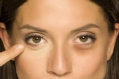 BEAUTY – Vanno di moda le borse sotto gli occhi