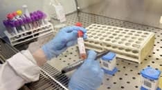 CORONAVIRUS - In Piemonte personale sanitario aumentato di 1467 unità: 52 in Canavese