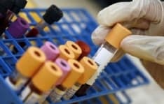 CANAVESE - Fase 2 della sanità, nuove regole contro il covid. Si prenotano anche i prelievi del sangue