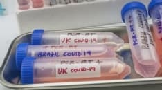 COVID - Prossimo passo: il vaccino universale