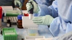 COVID IN CANAVESE - Lieve calo dei contagi, stabili le terapie intensive - I DATI COMUNE PER COMUNE