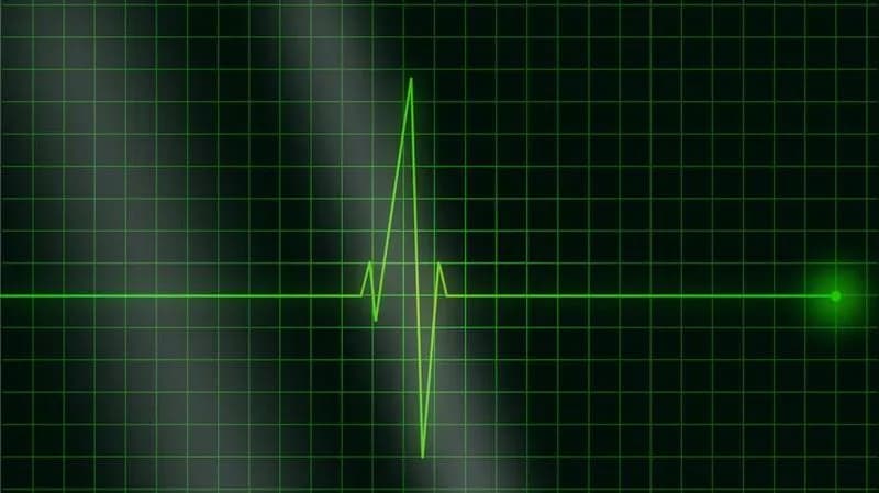 CANAVESE - Suicidio medicalmente assistito, la Regione Piemonte precisa la sua posizione