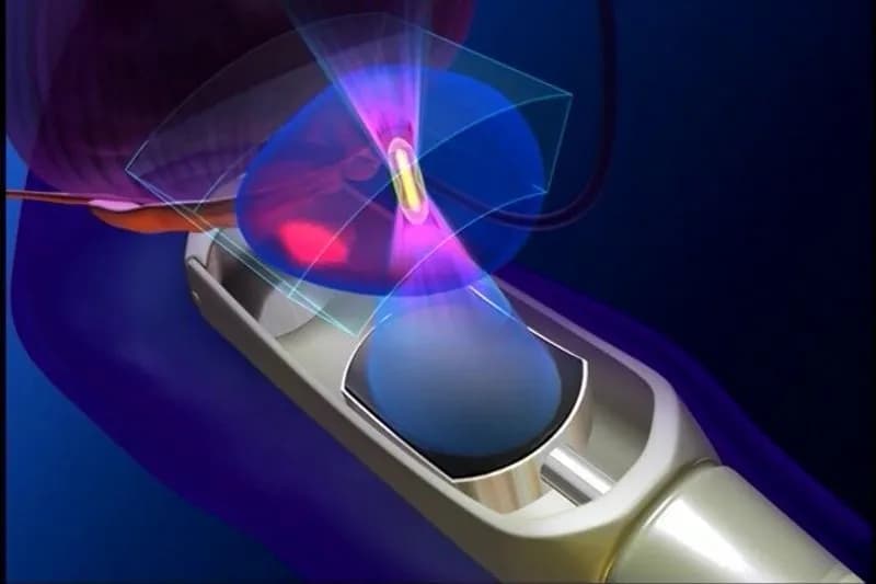 CHIVASSO - Il tumore alla prostata si opera con il nuovo sistema robotico: oggi i primi tre interventi chirurgici